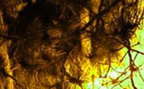 ���(z��i)��(b��o)��ϵ�y(t��ng)�����ƶ�